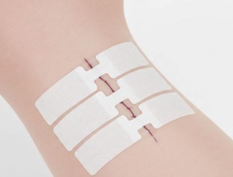 Wound Closure Strips